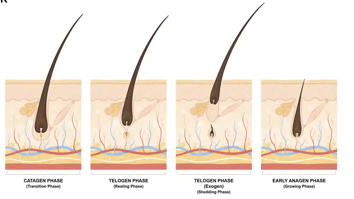 درمان قطعی ریزش مو در مردان به زودی